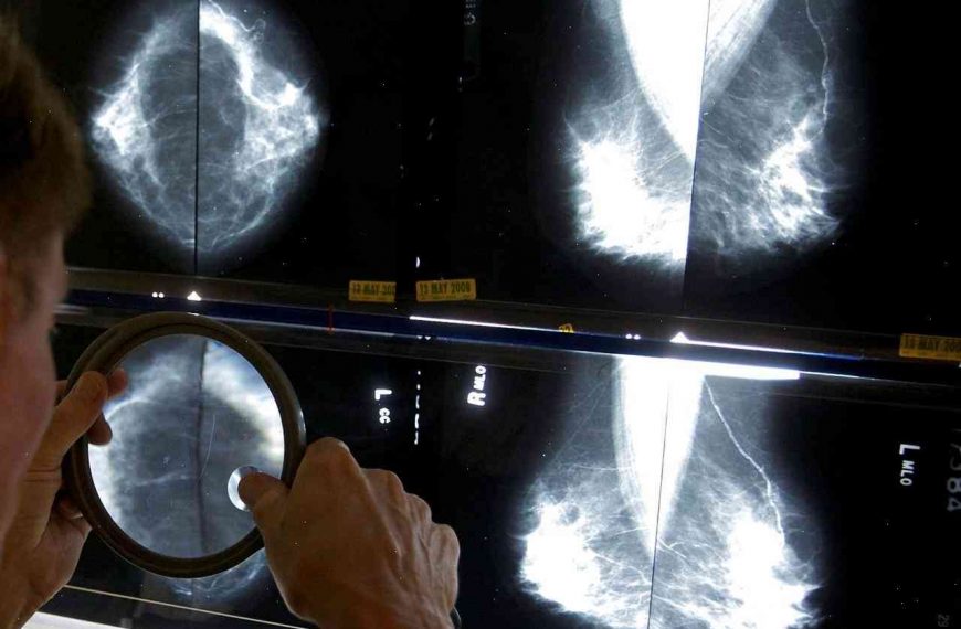 Missing key research, Canada’s mammography guidelines were built on flawed research, new study finds